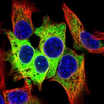 Immunocytochemistry/Immunofluorescence: Carboxylesterase 1/CES1 Antibody [NBP2-48854] - Analysis of human cell line Hep G2 shows positivity in endoplasmic reticulum. Antibody staining is shown in green.