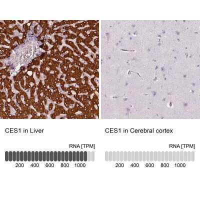 Immunohistochemistry-Paraffin: Carboxylesterase 1/CES1 Antibody [NBP2-48854] - Analysis in human liver and cerebral cortex tissues using NBP2-48854 antibody. Corresponding CES1 RNA-seq data are presented for the same tissues.