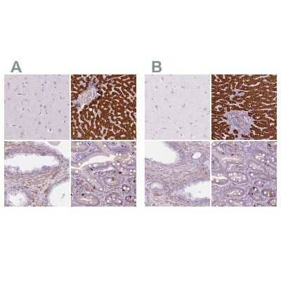 <b>Independent Antibodies Validation and Orthogonal Strategies Validation.</b>Immunohistochemistry-Paraffin: Carboxylesterase 1/CES1 Antibody [NBP2-48854] - Staining of human cerebral cortex, liver, prostate and upper gastrointestinal using Anti-CES1 antibody NBP2-48854 (A) shows similar protein distribution across tissues to independent antibody NBP1-85691 (B).