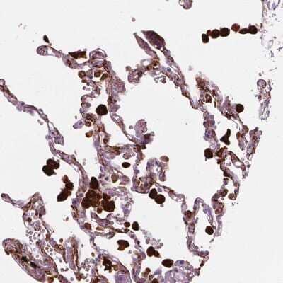 Immunohistochemistry-Paraffin: Carboxylesterase 1/CES1 Antibody [NBP2-48854] - Staining of human lung shows strong cytoplasmic positivity in macrophages.