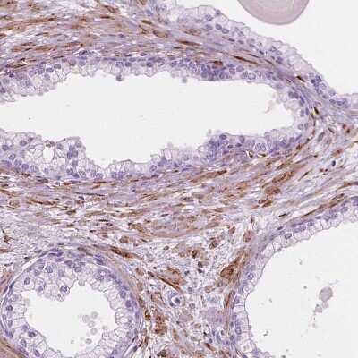 Immunohistochemistry-Paraffin: Carboxylesterase 1/CES1 Antibody [NBP2-48854] - Staining of human prostate shows moderate cytoplasmic positivity in smooth muscle cells.