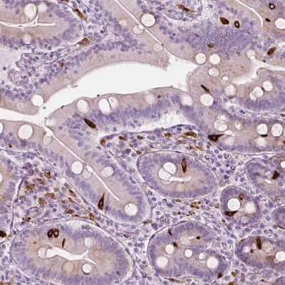 Immunohistochemistry-Paraffin: Carboxylesterase 1/CES1 Antibody [NBP2-48854] - Staining of human small intestine shows strong cytoplasmic positivity in enteroendocrine cells.