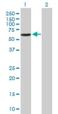 Western Blot: Carboxylesterase 3/CES3/Esterase 31 Antibody [H00023491-B01P] - Analysis of CES3 expression in transfected 293T cell line by CES3 polyclonal antibody.  Lane 1: CES3 transfected lysate(62.48 KDa). Lane 2: Non-transfected lysate.