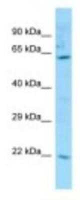 Western Blot: Carboxylesterase 3/CES3/Esterase 31 Antibody [NBP1-98271] - THP-1 Cell Lysate, 1.0ug/ml, Gel Concentration: 12%