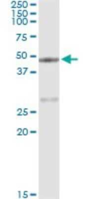Immunoprecipitation: Carboxypeptidase A1/CPA1 Antibody (3F11) [H00001357-M01] - Analysis of CPA1 transfected lysate using anti-CPA1 monoclonal antibody and Protein A Magnetic Bead, and immunoblotted with CPA1 MaxPab rabbit polyclonal antibody.