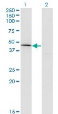 Western Blot: Carboxypeptidase A1/CPA1 Antibody (3F11) [H00001357-M01] - Analysis of CPA1 expression in transfected 293T cell line by CPA1 monoclonal antibody (M01), clone 3F11.Lane 1: CPA1 transfected lysate(47.1 KDa).Lane 2: Non-transfected lysate.