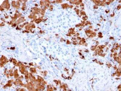 Immunohistochemistry-Paraffin: Carboxypeptidase A1/CPA1 Antibody (CPA1/2712) - Azide and BSA Free [NBP2-79880] - Formalin-fixed, paraffin-embedded human Pancreas stained with Carboxypeptidase A1 / CPA1 Mouse Monoclonal Antibody (CPA1/2712).