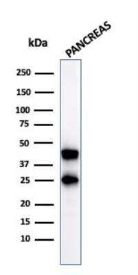 Western Blot: Carboxypeptidase A1/CPA1 Antibody (CPA1/2712) - Azide and BSA Free [NBP2-79880] - Western Blot Analysis of pancreatic tissue lysate using CPA1 Mouse Monoclonal Antibody (CPA1/2712).