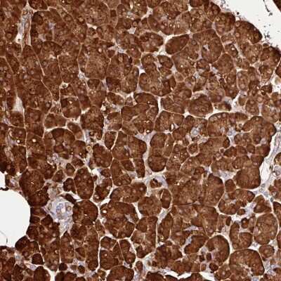 Immunohistochemistry-Paraffin: Carboxypeptidase A1/CPA1 Antibody [NBP2-33640] - Staining of human pancreas shows strong cytoplasmic positivity in exocrine glandular cells.