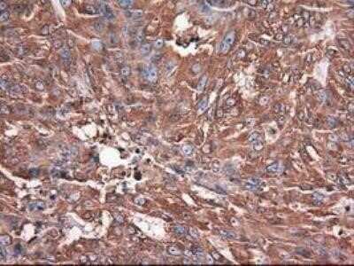 Immunohistochemistry: Carboxypeptidase A1/CPA1 Antibody (OTI2A3) - Azide and BSA Free [NBP2-70431] - Staining of paraffin-embedded endometrium using anti-Carboxypeptidase A mouse monoclonal antibody.