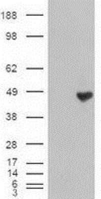 Western Blot: Carboxypeptidase A1/CPA1 Antibody (OTI2A3) - Azide and BSA Free [NBP2-70431] - HEK293T cells were transfected with the pCMV6-ENTRY control (Left lane) or pCMV6-ENTRY Carboxypeptidase A(Right lane) cDNA for 48 hrs and lysed. Equivalent amounts of cell lysates (5 ug per lane) were separated by SDS-PAGE and immunoblotted with anti-Carb