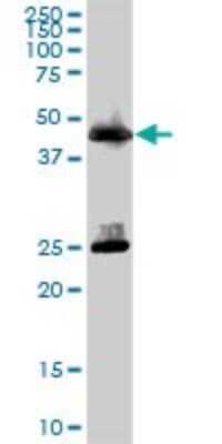 Western Blot: Carboxypeptidase A1/CPA1 Antibody [H00001357-B01P] - Analysis of CPA1 expression in human pancreas.