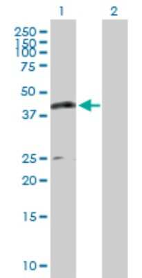 Western Blot: Carboxypeptidase A1/CPA1 Antibody [H00001357-D01P] - Analysis of CPA1 expression in transfected 293T cell line by CPA1 polyclonal antibody.Lane 1: CPA1 transfected lysate(47.10 KDa).Lane 2: Non-transfected lysate.