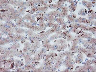 Immunohistochemistry-Paraffin: Carboxypeptidase A2 Antibody (1C7) [NBP2-01992] - Staining of paraffin-embedded Human liver tissue using anti-Carboxypeptidase A2 mouse monoclonal antibody.