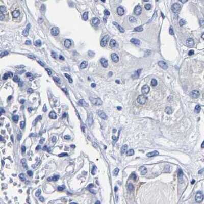 <b>Independent Antibodies Validation. </b>Immunohistochemistry-Paraffin: Carboxypeptidase A2/CPA2 Antibody [NBP1-86028] - Staining of human kidney.