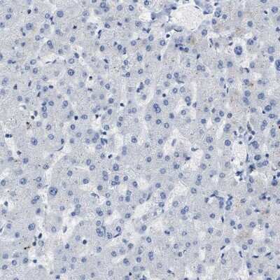 Immunohistochemistry-Paraffin: Carboxypeptidase A2/CPA2 Antibody [NBP1-87555] - Staining of human liver shows low expression as expected.