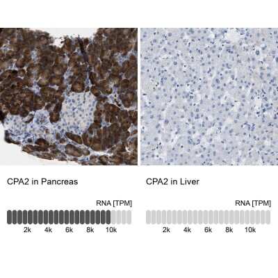 <b>Orthogonal Strategies Validation. </b>Immunohistochemistry-Paraffin: Carboxypeptidase A2/CPA2 Antibody [NBP1-87555] - Staining in human pancreas and liver tissues using anti-CPA2 antibody. Corresponding CPA2 RNA-seq data are presented for the same tissues.