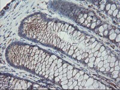 Immunohistochemistry: Carboxypeptidase A2/CPA2 Antibody (OTI1C7) - Azide and BSA Free [NBP2-70440] - Staining of paraffin-embedded Human colon tissue using anti-Carboxypeptidase A2 mouse monoclonal antibody.
