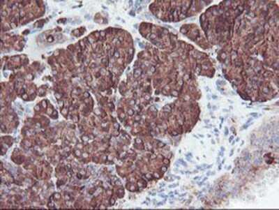 Immunohistochemistry: Carboxypeptidase A2/CPA2 Antibody (OTI1C7) - Azide and BSA Free [NBP2-70440] - Staining of paraffin-embedded Human pancreas tissue using anti-Carboxypeptidase A2 mouse monoclonal antibody.