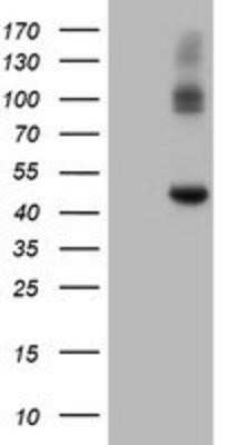 Western Blot: Carboxypeptidase A2/CPA2 Antibody (OTI1C7) - Azide and BSA Free [NBP2-70440] - HEK293T cells were transfected with the pCMV6-ENTRY control (Left lane) or pCMV6-ENTRY Carboxypeptidase A2 (Right lane) cDNA for 48 hrs and lysed. Equivalent amounts of cell lysates (5 ug per lane) were separated by SDS-PAGE and immunoblotted with anti-Ca