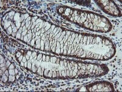 Immunohistochemistry: Carboxypeptidase A2/CPA2 Antibody (OTI3D8) - Azide and BSA Free [NBP2-70443] - Analysis of Human colon tissue. (Heat-induced epitope retrieval by 10mM citric buffer, pH6.0, 120C for 3min)
