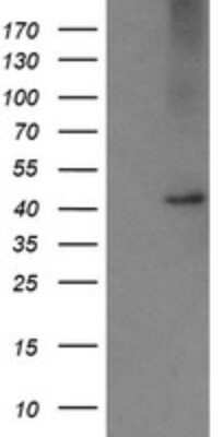 Western Blot: Carboxypeptidase A2/CPA2 Antibody (OTI3D8) - Azide and BSA Free [NBP2-70443] - Analysis of HEK293T cells were transfected with the pCMV6-ENTRY control (Left lane) or pCMV6-ENTRY CPA2.
