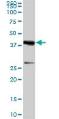 Western Blot: Carboxypeptidase A2/CPA2 Antibody [H00001358-B01P] - Analysis of CPA2 expression in human pancreas.