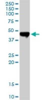 Western Blot: Carboxypeptidase A2/CPA2 Antibody [H00001358-D01P] - Analysis of CPA2 expression in human pancreas.