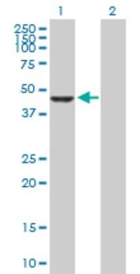 Western Blot: Carboxypeptidase A2/CPA2 Antibody [H00001358-D01P] - Analysis of CPA2 expression in transfected 293T cell line by CPA2 polyclonal antibody.Lane 1: CPA2 transfected lysate(46.80 KDa).Lane 2: Non-transfected lysate.