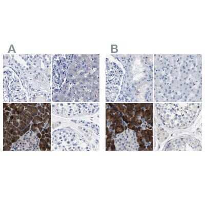 Western Blot: Carboxypeptidase A2/CPA2 Antibody [NBP1-86028] - Staining of human kidney, liver, pancreas and testis using Anti-CPA2 antibody NBP1-86028 (A) shows similar protein distribution across tissues to independent antibody NBP1-87555 (B).