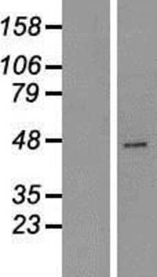 Western Blot: Carboxypeptidase A2 Overexpression Lysate (Adult Normal) [NBP2-10775] Left-Empty vector transfected control cell lysate (HEK293 cell lysate); Right -Over-expression Lysate for Carboxypeptidase A2.