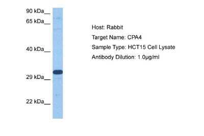 Western Blot: Carboxypeptidase A4/CPA4 Antibody [NBP2-84589] - Host: Rabbit. Target Name: CPA4. Sample Tissue: Human HCT15 Whole Cell lysates. Antibody Dilution: 1ug/ml