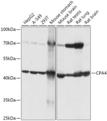 Western Blot: Carboxypeptidase A4/CPA4 Antibody [NBP2-92372] - Analysis of extracts of various cell lines, using Carboxypeptidase A4/CPA4 at 1:1000 dilution.Secondary antibody: HRP Goat Anti-Rabbit IgG (H+L) at 1:10000 dilution.Lysates/proteins: 25ug per lane.Blocking buffer: 3% nonfat dry milk in TBST.Detection: ECL Basic Kit .Exposure time: 5s.