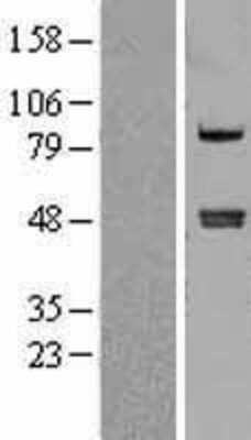 Western Blot: Carboxypeptidase A4 Overexpression Lysate (Adult Normal) [NBL1-09426] Left-Empty vector transfected control cell lysate (HEK293 cell lysate); Right -Over-expression Lysate for Carboxypeptidase A4.