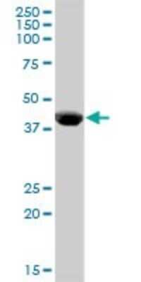 Western Blot: Carboxypeptidase B1/CPB1 Antibody [H00001360-B01] - Analysis of CPB1 expression in human pancreas.