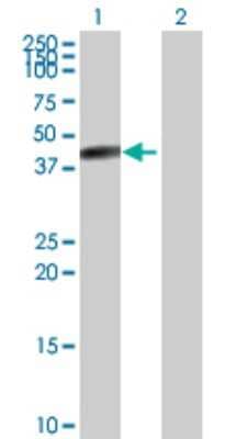 Western Blot: Carboxypeptidase B1/CPB1 Antibody [H00001360-D01P] - Analysis of CPB1 expression in transfected 293T cell line by CPB1 rabbit polyclonal antibody.Lane 1: CPB1 transfected lysate(47.40 KDa).Lane 2: Non-transfected lysate.
