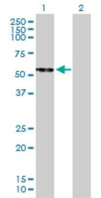 Western Blot: Carboxypeptidase B2/CPB2 Antibody [H00001361-B01P] - Analysis of CPB2 expression in transfected 293T cell line by CPB2 polyclonal antibody.  Lane 1: CPB2 transfected lysate(46.53 KDa). Lane 2: Non-transfected lysate.