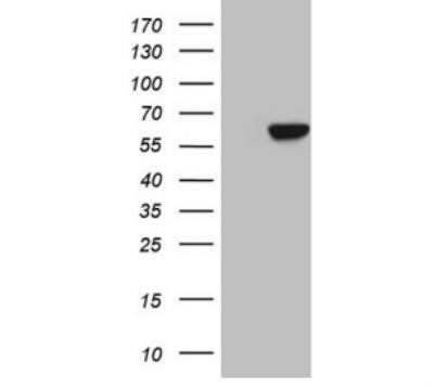 Western Blot: Carboxypeptidase M Antibody (OTI2D11) - Azide and BSA Free [NBP2-70446] - HEK293T cells were transfected with the pCMV6-ENTRY control (Left lane) or pCMV6-ENTRY CPM ( Right lane) cDNA for 48 hrs and lysed. Equivalent amounts of cell lysates (5 ug per lane) were separated by SDS-PAGE and immunoblotted with anti CPM.(1:2000).