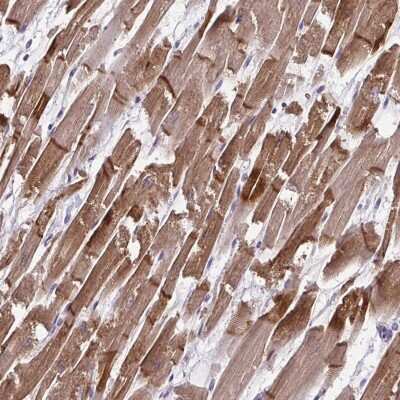 Immunohistochemistry-Paraffin Cardiac Leiomodin Antibody