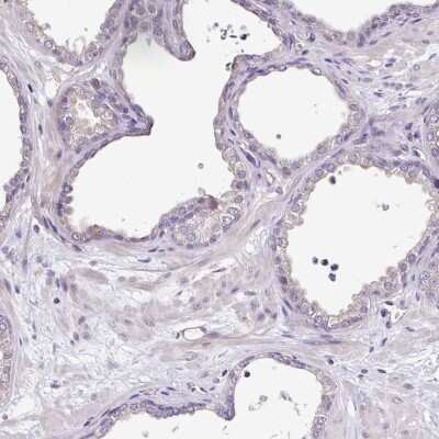 Immunohistochemistry-Paraffin Cardiac Leiomodin Antibody