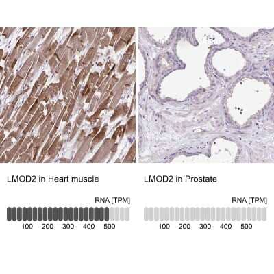 Immunohistochemistry-Paraffin Cardiac Leiomodin Antibody