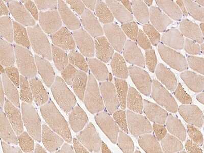 Immunohistochemistry-Paraffin Cardiac Leiomodin Antibody