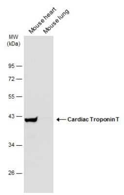 Western Blot: Cardiac Troponin T Antibody [NBP3-13030] - Various tissue extracts (50 ug) were separated by 10% SDS-PAGE, and the membrane was blotted with Cardiac Troponin T antibody (NBP3-13030) diluted at 1:1000. The HRP-conjugated anti-rabbit IgG antibody (NBP2-19301) was used to detect the primary antibody.