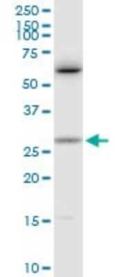 Western Blot: Cardiotrophin-1/CT-1 Antibody [H00001489-D01P] - Analysis of CTF1 expression in Jurkat.