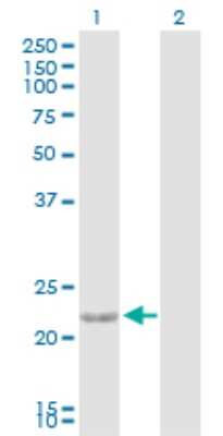 Western Blot: Cardiotrophin-1/CT-1 Antibody [H00001489-D01P] - Analysis of CTF1 expression in transfected 293T cell line by CTF1 polyclonal antibody.Lane 1: CTF1 transfected lysate(21.20 KDa).Lane 2: Non-transfected lysate.