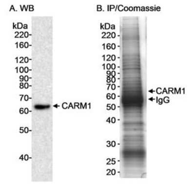 Western Blot: Carm1 Antibody [NB200-341] - Whole HeLa cell lysate (25 mcg for WB in A; 5 mg for IP in B).antibody used at 0.1 mcg/ml for WB and at 4 mcg/5 mg lysate for IP.  Detection: Chemiluminescence A. Coomassie stain in B. Band  was verified by mass spectrometry.