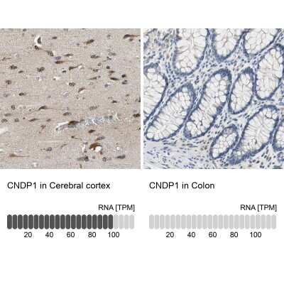 <b>Orthogonal Strategies Validation. </b>Immunohistochemistry-Paraffin: Carnosine Dipeptidase 1/CNDP1 Antibody [NBP1-85528] - Staining in human cerebral cortex and colon tissues using anti-CNDP1 antibody. Corresponding CNDP1 RNA-seq data are presented for the same tissues.