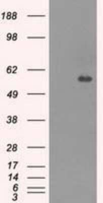 Western Blot: Carnosine Dipeptidase 1/CNDP1 Antibody (OTI2F8) [NBP1-47702] - HEK293T cells were transfected with the pCMV6-ENTRY control (Left lane) or pCMV6-ENTRY CNDP1 (Right lane) cDNA for 48 hrs and lysed. Equivalent amounts of cell lysates (5 ug per lane) were separated by SDS-PAGE and immunoblotted with anti-CNDP1.