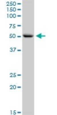 Western Blot: Carnosine Dipeptidase 1/CNDP1 Antibody [H00084735-D01P] - Analysis of CNDP1 expression in HeLa.