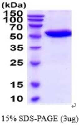 SDS-Page: Carnosine Dipeptidase 1/CNDP1 Recombinant Protein [NBP2-52380] - 15% SDS Page (3 ug)